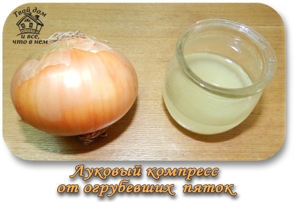 Луковый компресс от огрубевших пяток Луковый компресс от огрубевших пяток
