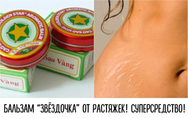 Бальзам "Звёздочка" от растяжек - суперсредство!