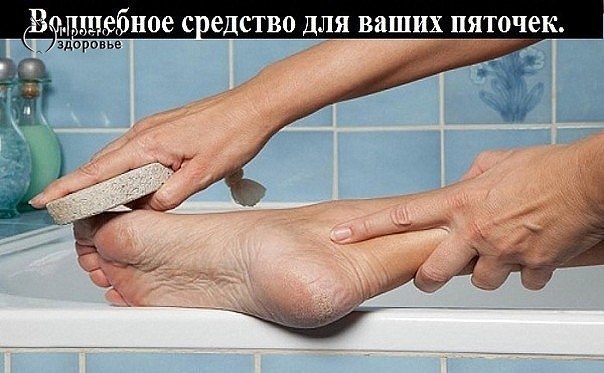 Волшебное средство для ваших пяточек. Эффект потрясающий! Попробуйте и убедитесь сами! Моментальный 