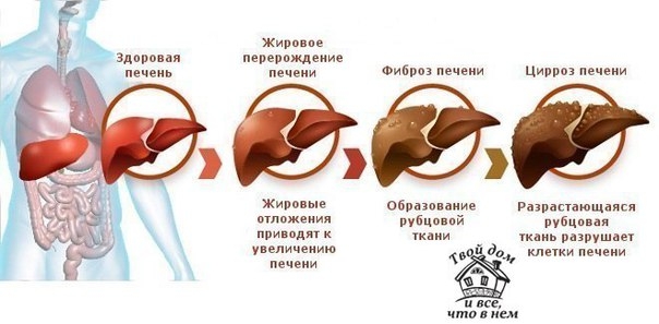 Как ухаживать за своей печенью.