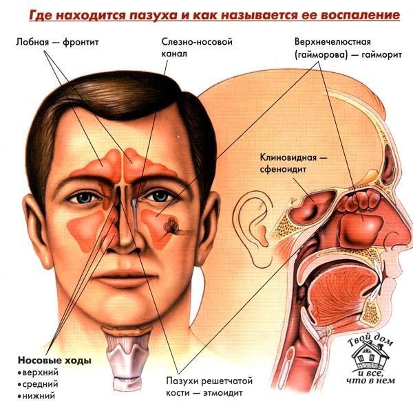 Как быстро избавиться от насморка и кашля.