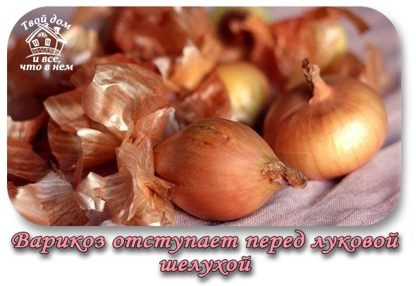 Варикоз отступает перед луковой шелухой